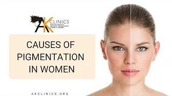 Face Pigmentation || Main Causes of Pigmentation in Women - Dr Aman Dua