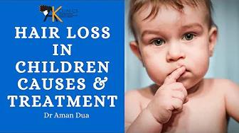 Hair Loss in Children ! Causes and Treatment | Alopecia Areata | Dr Aman Dua