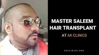 MASTER SLEEM REVISION HAIR TRANSPLANT BY DR KAPIL DUA